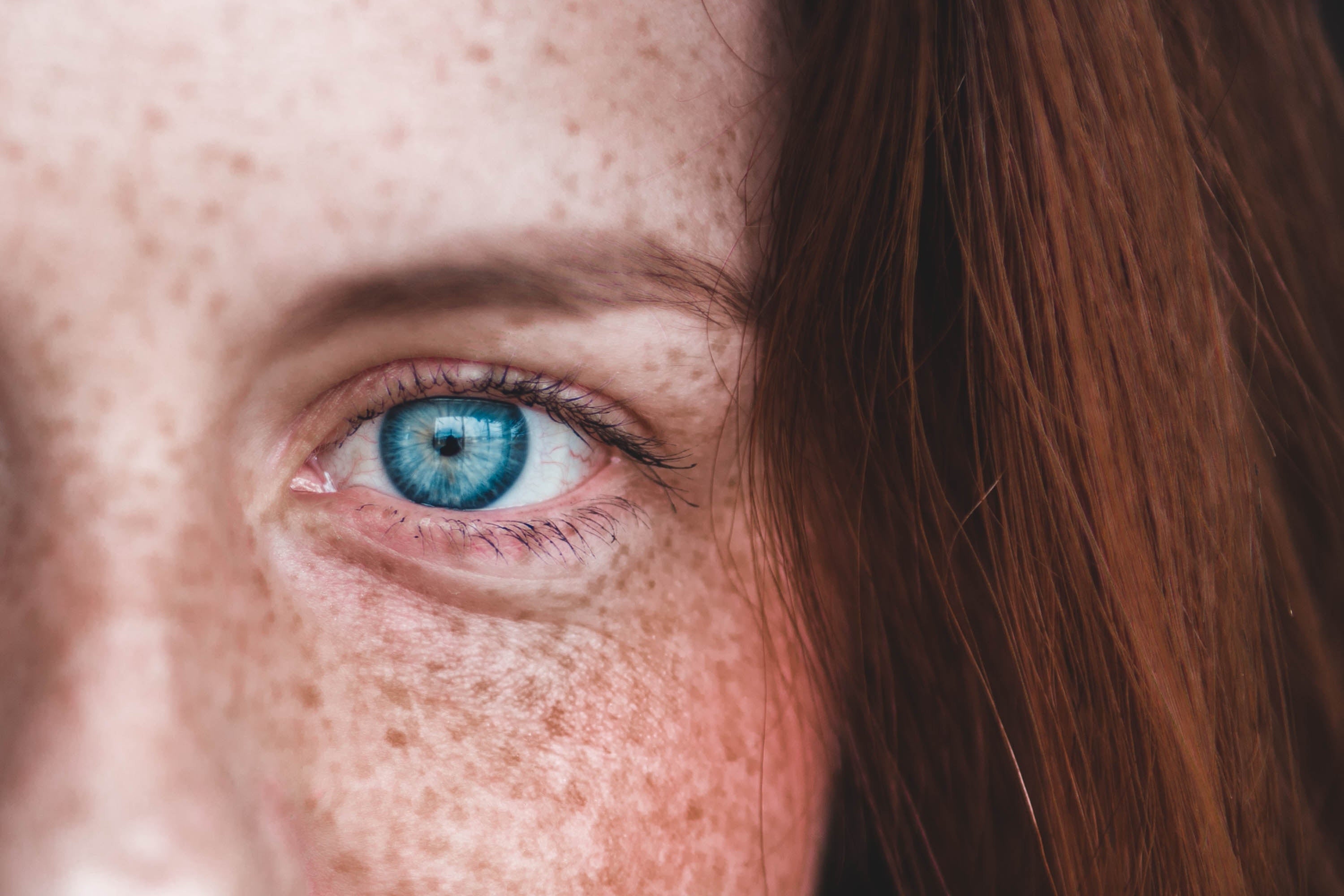 The Definitive Guide to Brown Spots | BeautyRx by Dr. Schultz